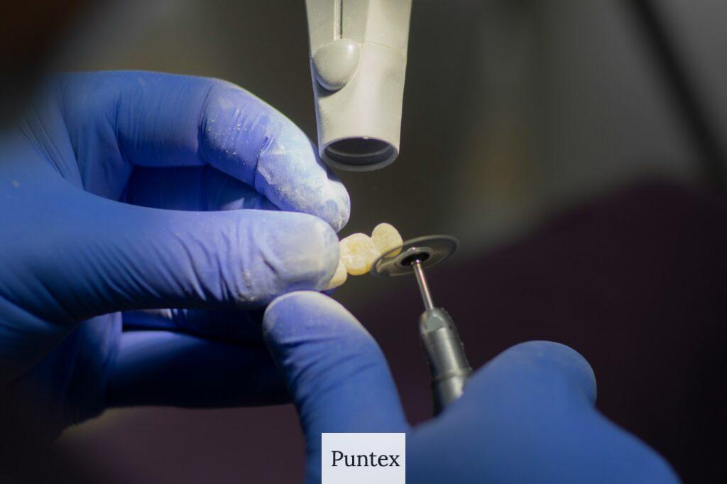 Guía completa de implantes dentales: Beneficios, proceso y cuidados