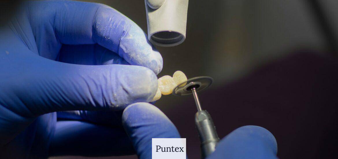 Guía completa de implantes dentales: Beneficios, proceso y cuidados