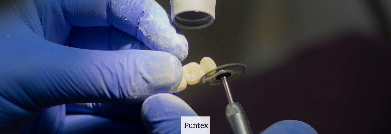 Guía completa de implantes dentales: Beneficios, proceso y cuidados