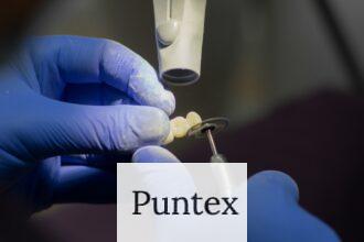 Guía completa de implantes dentales: Beneficios, proceso y cuidados