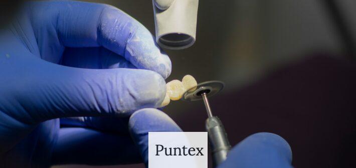 Guía completa de implantes dentales: Beneficios, proceso y cuidados