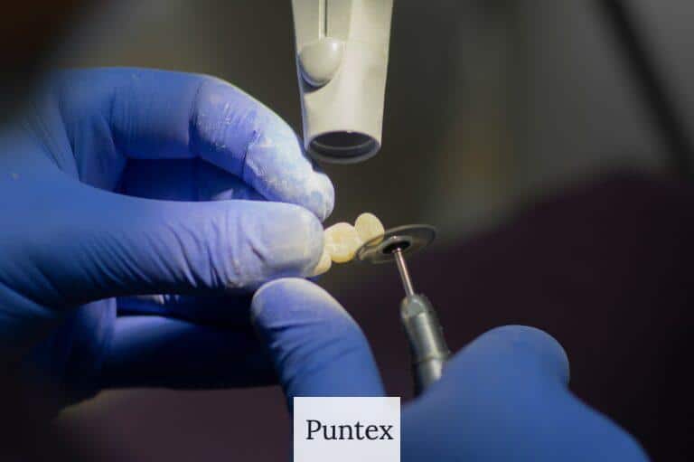 Guía completa de implantes dentales: Beneficios, proceso y cuidados